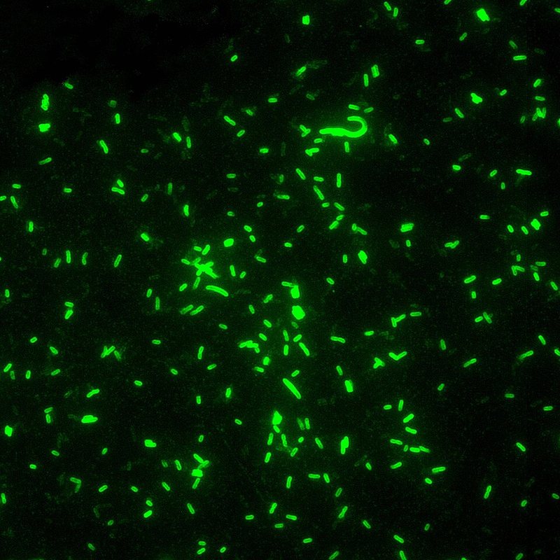 Plague bacteria under a fluorescence microscope